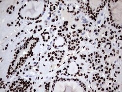 HNRNPM Monoclonal Antibody (OTI4C9), TrueMAB , OriGene 100 &mu;L; Unconjugated:Antibodies,