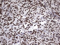 HNRNPM Monoclonal Antibody (OTI4C9), TrueMAB , OriGene 100 &mu;L; Unconjugated:Antibodies,
