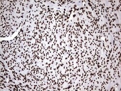 HNRNPM Monoclonal Antibody (OTI4C9), TrueMAB , OriGene 100 &mu;L; Unconjugated:Antibodies,