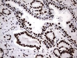 HNRNPM Monoclonal Antibody (OTI4C9), TrueMAB , OriGene 100 &mu;L; Unconjugated:Antibodies,