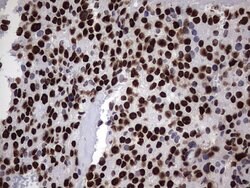 HNRNPM Monoclonal Antibody (OTI4C9), TrueMAB , OriGene 100 &mu;L; Unconjugated:Antibodies,