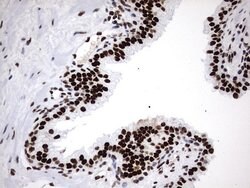 HNRNPM Monoclonal Antibody (OTI4C9), TrueMAB , OriGene 100 &mu;L; Unconjugated:Antibodies,