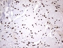 HNRNPM Monoclonal Antibody (OTI4C9), TrueMAB , OriGene 100 &mu;L; Unconjugated:Antibodies,