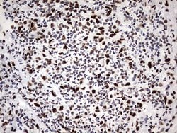 HNRNPM Monoclonal Antibody (OTI4C9), TrueMAB , OriGene 100 &mu;L; Unconjugated:Antibodies,