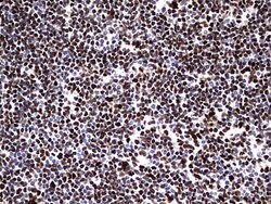 HNRNPM Monoclonal Antibody (OTI4C9), TrueMAB , OriGene 100 &mu;L; Unconjugated:Antibodies,