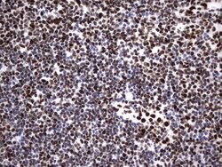 HNRNPM Monoclonal Antibody (OTI4C9), TrueMAB , OriGene 100 &mu;L; Unconjugated:Antibodies,