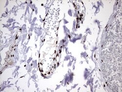HNRNPM Monoclonal Antibody (OTI4C9), TrueMAB , OriGene 100 &mu;L; Unconjugated:Antibodies,
