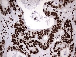 HNRNPM Monoclonal Antibody (OTI4C9), TrueMAB , OriGene 100 &mu;L; Unconjugated:Antibodies,