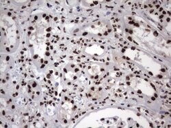 HNRNPM Monoclonal Antibody (OTI4C9), TrueMAB , OriGene 100 &mu;L; Unconjugated:Antibodies,