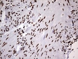 HNRNPM Monoclonal Antibody (OTI4C9), TrueMAB , OriGene 100 &mu;L; Unconjugated:Antibodies,