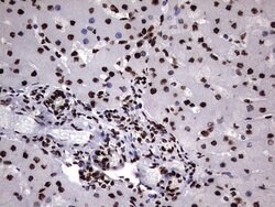 HNRNPM Monoclonal Antibody (OTI4C9), TrueMAB , OriGene 100 &mu;L; Unconjugated:Antibodies,
