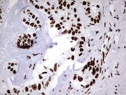 HNRNPM Monoclonal Antibody (OTI4C9), TrueMAB , OriGene 100 &mu;L; Unconjugated:Antibodies,