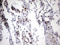 HNRNPM Monoclonal Antibody (OTI4C9), TrueMAB , OriGene 100 &mu;L; Unconjugated:Antibodies,