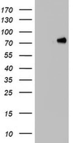 HNRNPM Monoclonal Antibody (OTI3F3), TrueMAB , OriGene 100 &mu;L; Unconjugated:Antibodies,