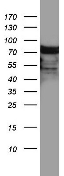 HNRNPM Monoclonal Antibody (OTI4C9), TrueMAB , OriGene 100 &mu;L; Unconjugated:Antibodies,