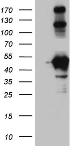 HOMER1 Monoclonal Antibody (OTI3G5), TrueMAB , OriGene 30 &mu;L; Unconjugated:Antibodies,