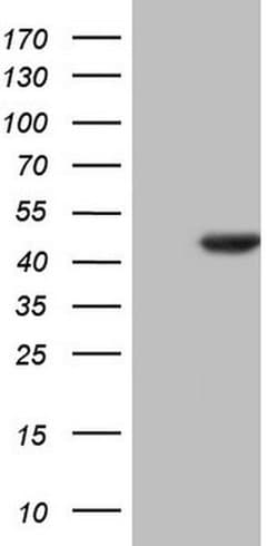 HOMER2 Monoclonal Antibody (OTI4D4), TrueMAB , OriGene 100 &mu;L; Unconjugated:Antibodies,
