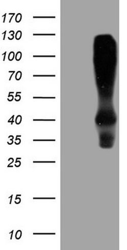HOMER2 Monoclonal Antibody (OTI1H3), TrueMAB , OriGene 30 &mu;L; Unconjugated:Antibodies,