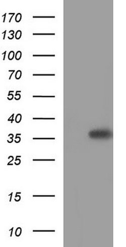 HORMAD2 Monoclonal Antibody (OTI2E2), TrueMAB , OriGene:Antibodies:Primary