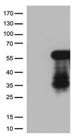 HOXA2 Mouse anti-Human, Clone: OTI6A6, lyophilized, TrueMAB 100 &mu;g;