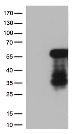 HOXA2 Monoclonal Antibody (OTI6A6), TrueMAB , OriGene:Antibodies:Primary