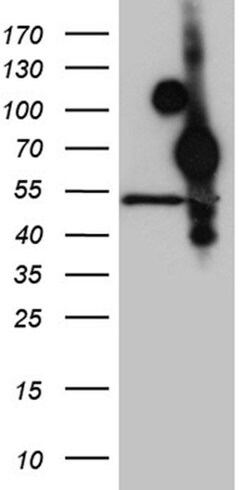HOXA3 Monoclonal Antibody (OTI8C5), TrueMAB , OriGene 100 &mu;L; Unconjugated:Antibodies,