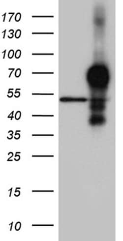 HOXA3 Monoclonal Antibody (OTI1A1), TrueMAB , OriGene 100 &mu;L; Unconjugated:Antibodies,