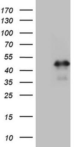 HOXC10 Monoclonal Antibody (OTI1E10), TrueMAB , OriGene:Antibodies:Primary
