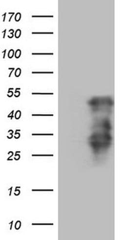 HOXC10 Monoclonal Antibody (OTI4D10), TrueMAB , OriGene:Antibodies:Primary