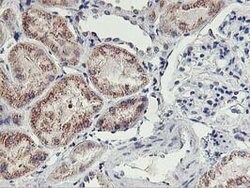 HOXC11 Mouse anti-Human, Clone: OTI2H9, lyophilized, TrueMAB 100 &mu;g;