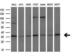 HOXC11 Monoclonal Antibody (OTI3G5), TrueMAB , OriGene 30 &mu;L; Unconjugated:Antibodies,
