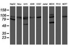 HOXC11 Mouse anti-Human, Clone: OTI2H9, lyophilized, TrueMAB 100 &mu;g;