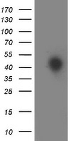 HOXC11 Monoclonal Antibody (OTI4H8), TrueMAB , OriGene 100 &mu;L; Unconjugated:Antibodies,