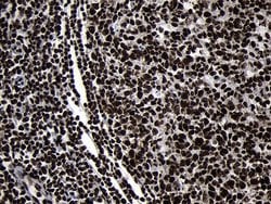 HOXC4 Monoclonal Antibody (OTI1F6), TrueMAB , OriGene 100 &mu;L; Unconjugated:Antibodies,