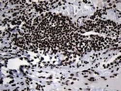 HOXC4 Monoclonal Antibody (OTI2D5), TrueMAB , OriGene 100 &mu;L; Unconjugated:Antibodies,