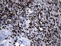 HOXC4 Monoclonal Antibody (OTI2D5), TrueMAB , OriGene 100 &mu;L; Unconjugated:Antibodies,