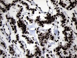 HOXC4 Monoclonal Antibody (OTI2D5), TrueMAB , OriGene:Antibodies:Primary