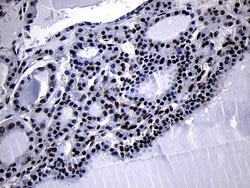 HOXC4 Monoclonal Antibody (OTI2D5), TrueMAB , OriGene:Antibodies:Primary