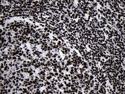 HOXC4 Monoclonal Antibody (OTI2D5), TrueMAB , OriGene 100 &mu;L; Unconjugated:Antibodies,