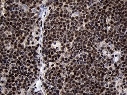 HOXC4 Monoclonal Antibody (OTI2D5), TrueMAB , OriGene 100 &mu;L; Unconjugated:Antibodies,