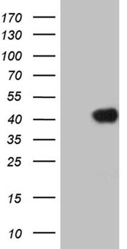 HOXC4 Monoclonal Antibody (OTI6B11), TrueMAB , OriGene:Antibodies:Primary