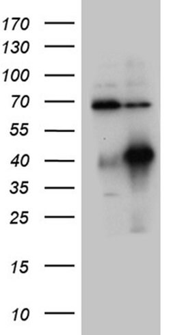 HOXC4 Monoclonal Antibody (OTI2D5), TrueMAB , OriGene 100 &mu;L; Unconjugated:Antibodies,