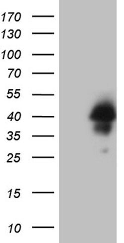 HOXD4 Mouse anti-Human, Clone: OTI1E5, lyophilized, TrueMAB 100 &mu;g;