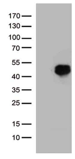 HOXD8 Mouse anti-Human, Clone: OTI2A1, TrueMAB , Origene 30 &mu;L; Unconjugated:Antibodies,