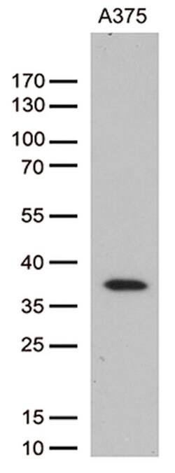 HOXD8 Mouse anti-Human, Clone: OTI2A1, lyophilized, TrueMAB 100 &mu;g;