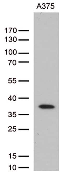 HOXD8 Mouse anti-Human, Clone: OTI2A1, TrueMAB , Origene 30 &mu;L; Unconjugated:Antibodies,