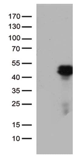 HOXD8 Mouse anti-Human, Clone: OTI2B6, lyophilized, TrueMAB 100 &mu;g;