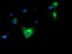 HP Monoclonal Antibody (OTI6H2), TrueMAB , OriGene 30 &mu;L; Unconjugated:Antibodies,