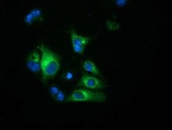 HP Monoclonal Antibody (OTI4H5), TrueMAB , OriGene 100 &mu;L; Unconjugated:Antibodies,