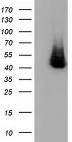 HP Monoclonal Antibody (OTI6H2), TrueMAB , OriGene:Antibodies:Primary Antibodies